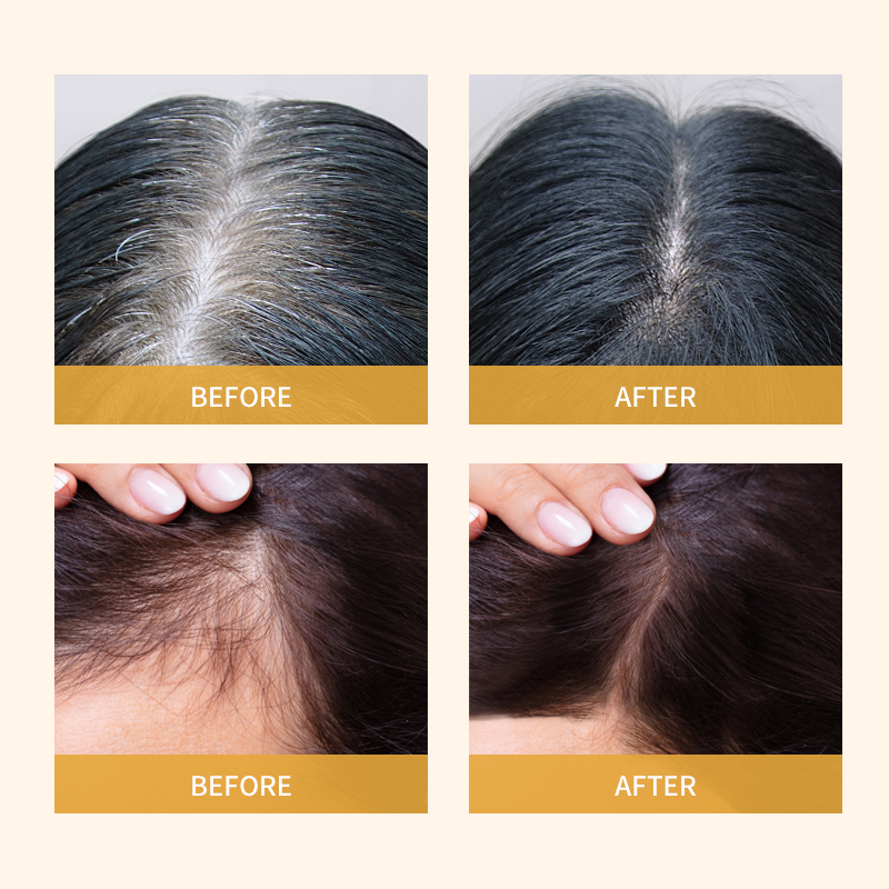 Pflanzliches Haarwachstumsserum mit Biotin und Ingwer