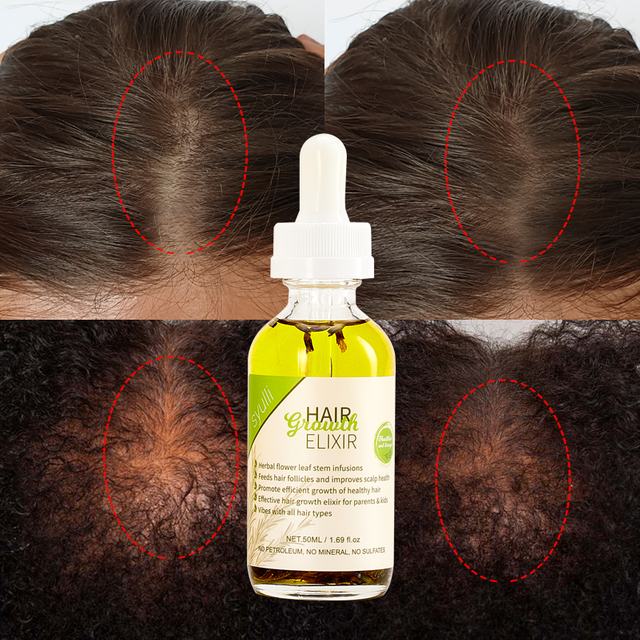 100 % natürliches Bio-Haarbehandlungsöl mit ayurvedischen Kräutern für schwarze Frauen